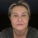 Marzec2021, Female, 57 years old